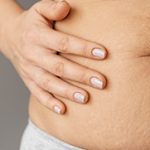 What to Know About Stretch Marks After Pregnancy 1
